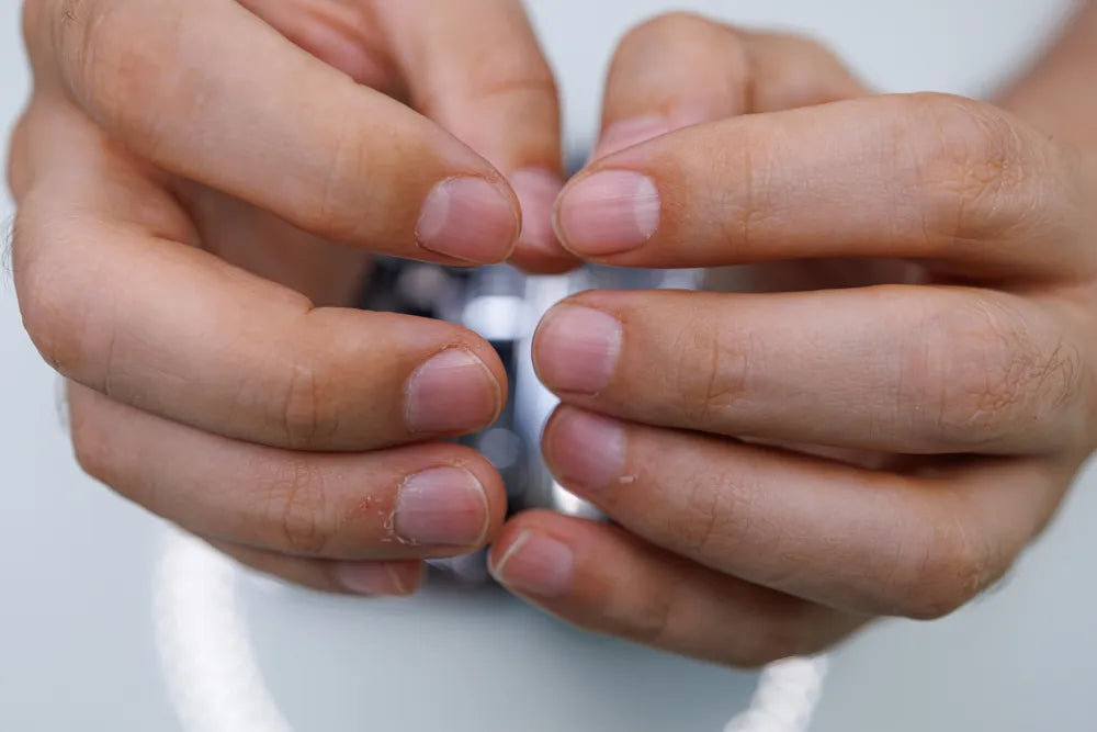 Close-up of healthy nails after tallow application