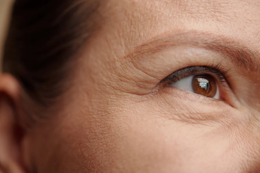 Close-up of eye/temple area with fine lines and wrinkles that may be soothed with tallow cream.